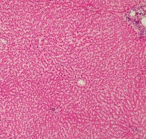 Una molecola sentinella protegge il fegato dal cancro