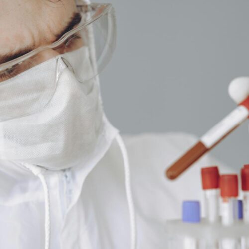 Nuovo test anticipa l’Alzheimer anni prima delle PET