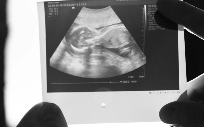 Microplastiche nella placenta: rischio di parto prematuro?