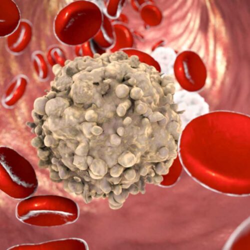 Nuova scoperta su Exportin-1: possibili cure per la leucemia