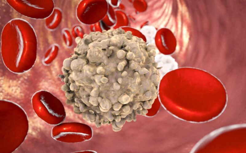 Nuova scoperta su Exportin-1: possibili cure per la leucemia