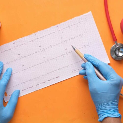 Lepodisiran, il farmaco che riduce del 94% il rischio cardiaco
