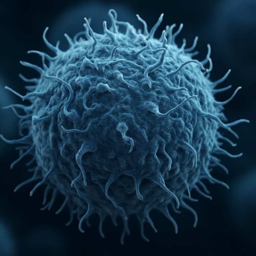 Osteosarcoma, bloccando AZIN1 e poliammine si ferma il tumore