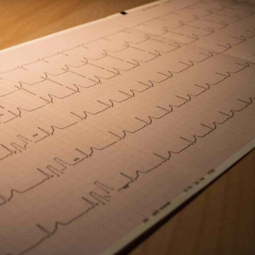 Mangiare solo di giorno protegge il cuore nei turnisti, lo studio