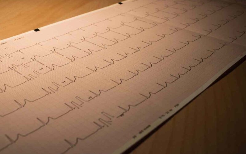 Mangiare solo di giorno protegge il cuore nei turnisti, lo studio