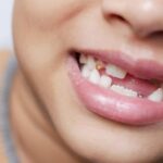 Un sorriso a metà - Foto di Towfiqu barbhuiya: https://www.pexels.com/it-it/foto/sorridente-ragazzo-bambino-denti-11242723/