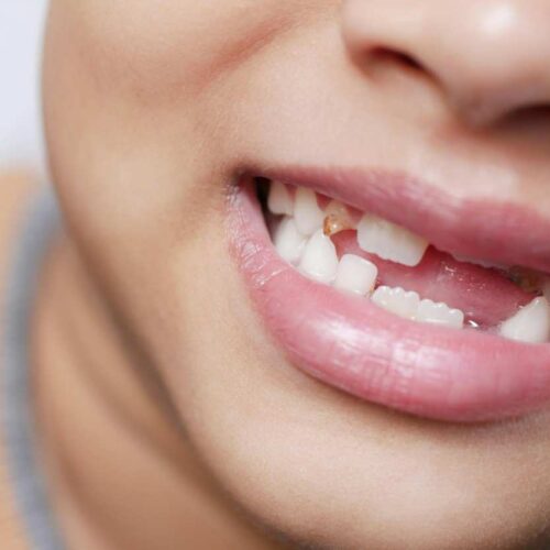 Addio otturazioni e impianti, arrivano i denti coltivati in laboratorio