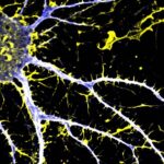 Farmaco contro la schizofrenia - Foto UC Davis Institute for Psychedelics and Neurotherapeutics