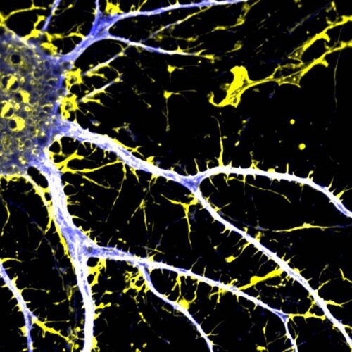 Un derivato dell’LSD contro la schizofrenia: nasce JRT