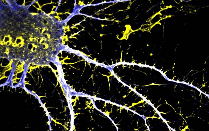 Un derivato dell’LSD contro la schizofrenia: nasce JRT