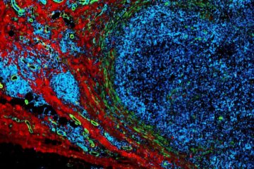 Impulsi elettrici a bassa intensità per stimolare il sistema immunitario contro il cancro