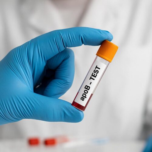Rischio cardiaco, apoB più attendibile del colesterolo