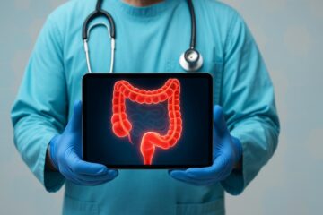 Una speranza contro il cancro al colon resistente alla chemioterapia