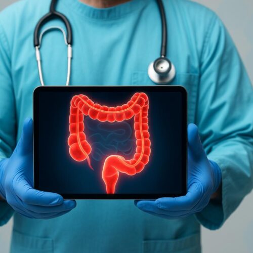 Una speranza contro il cancro al colon resistente alla chemioterapia