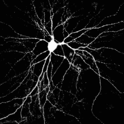 Alzheimer, scoperta la via usata dalla proteina Tau per diffondersi nel cervello